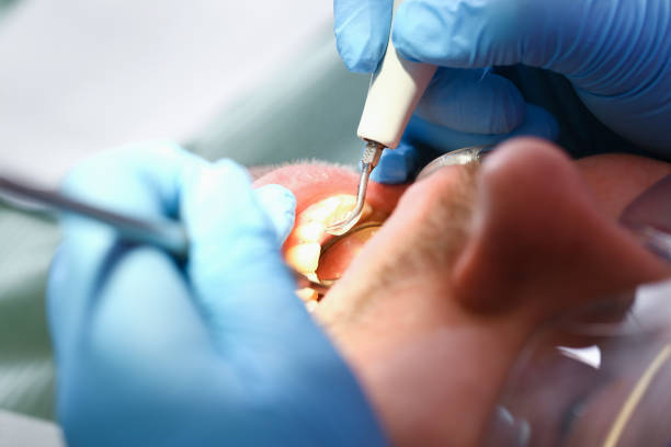 Best Emergency Dentist for Knocked-Out Tooth in Silver Ridge, NJ