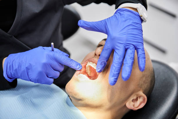 Best Broken or Cracked Tooth Emergency Dentist in Silver Ridge, NJ